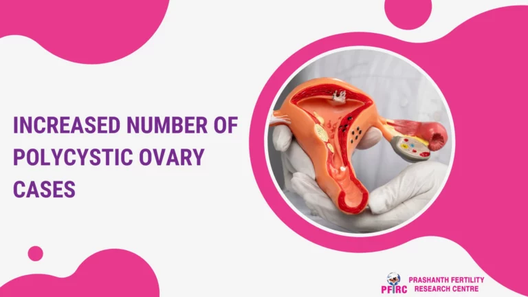 increased numer of polycystic ovary cases.webp