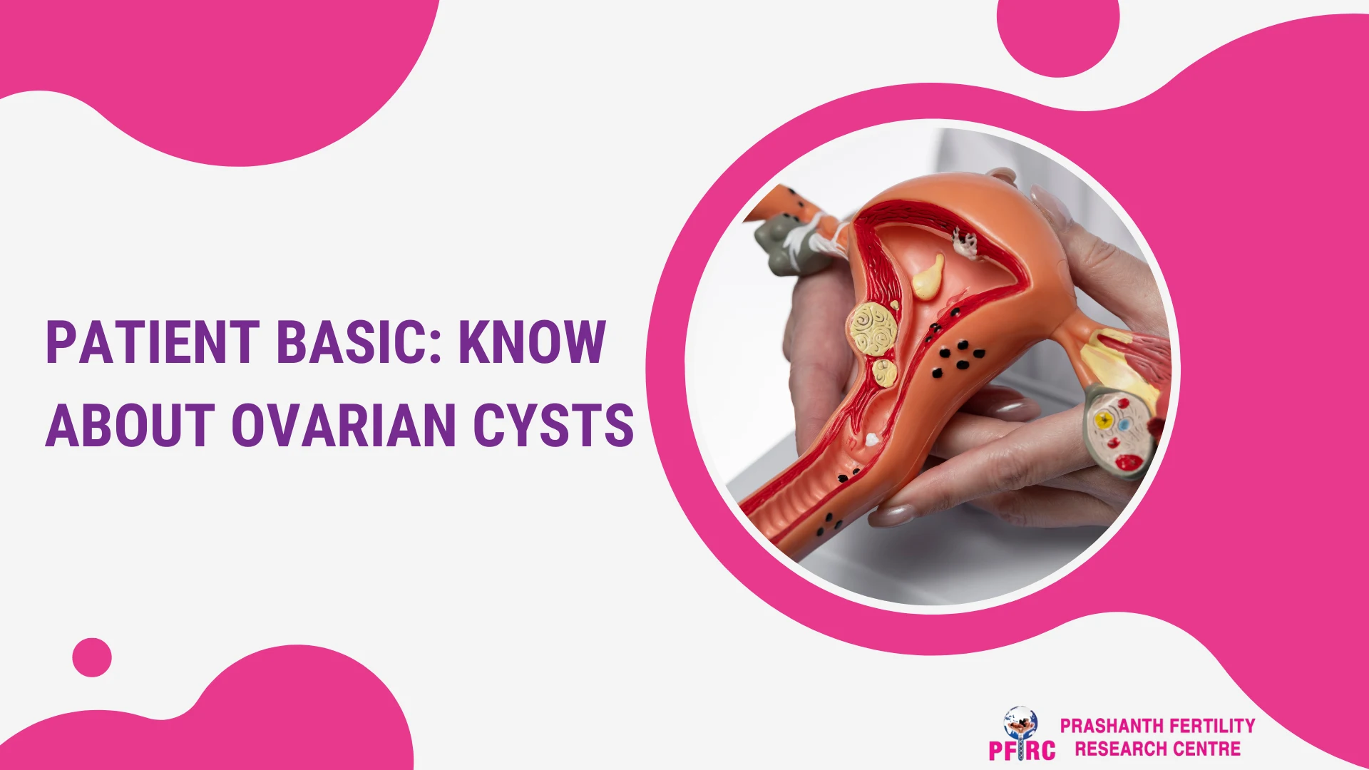 know about ovarian cystis