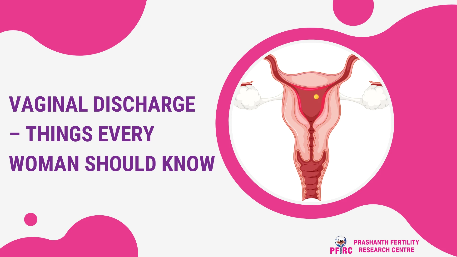 Vaginal Discharge – Things Every Woman Should Know