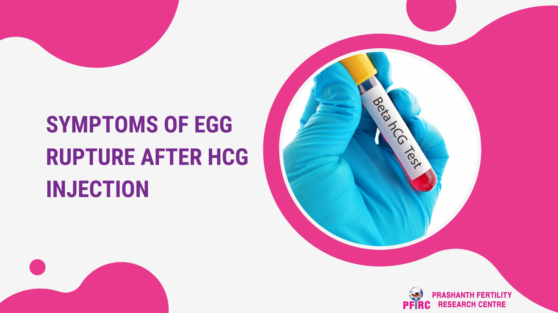 Symptoms Of Egg Rupture After hCG Injection (1)